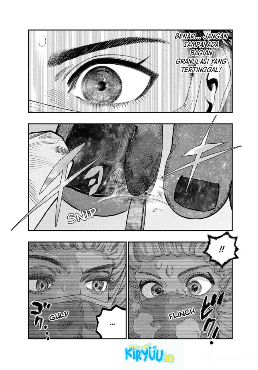 Koudou ni Hattatsu Shita Igaku wa Mahou to Kubetsu ga Tsukanai (THE ISEKAI DOCTOR) Chapter 43 - Halaman 5
